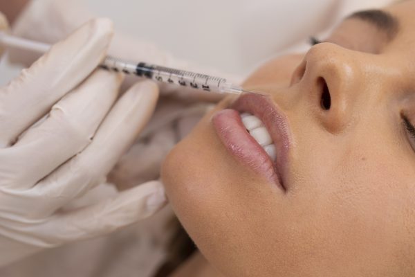 Revitalisierung und Modellierung der Lippen